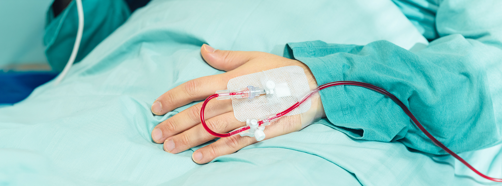 Potilaan käsi, jossa kanyyli punasolujen siirtämiseksi.